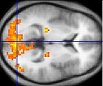 Functional magnetic resonance imaging.jpg