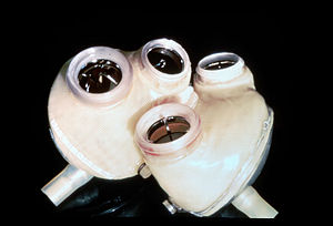Artificial heart: JARVIK-7 Heart, provided to ...