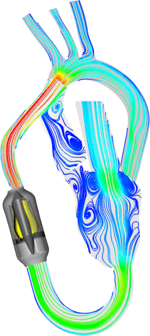 English: Simulation of a wave pump human ventr...