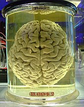 A human brain in jar Human brain in a vat.jpg