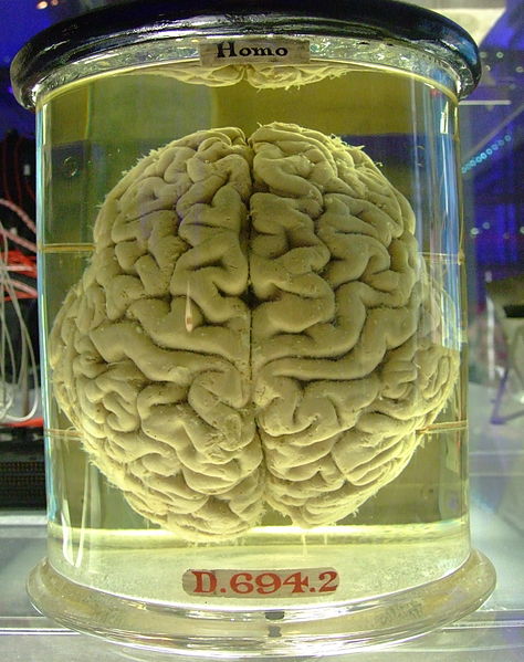 File:Human brain in a vat.jpg