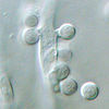 Aspergillus terreus aleurioconidia.jpg