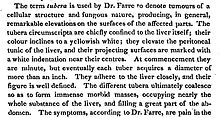 An 1814 American medical text showing British English spellings that were still in use ("tumours", "colour", "centres", etc.) British spellings in NEJM 1814.jpg