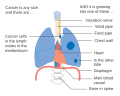 Thumbnail for version as of 15:17, 16 December 2015