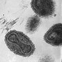 天然痘ウイルスのサムネイル