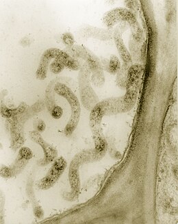 Floémsejtekben látható kukoricasatnyaság-spiroplazma