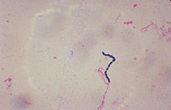 Streptococcus-bakteereita.