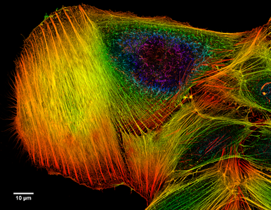 Deconvoluted microscope image, by Methylated603