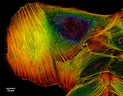 Proyeksi z dari sel osteosarkoma, diwarnai dengan phalloidin untuk memvisualisasikan filamen aktin.