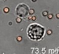 Archivo:S4-J774 Cells with Conidia in Liquid Media.ogv
