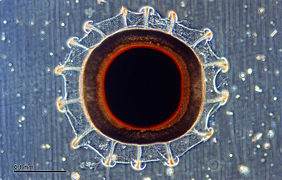 Statoblaste reproductif, vu au microscope.