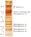 SDS-PAGEによる分離と銀染色が行われた、赤血球の膜タンパク質[18]。