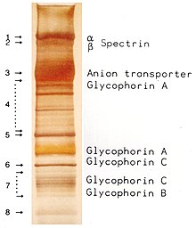 Red blood cell membrane proteins separated by SDS-PAGE and silverstained RBC Membrane Proteins SDS-PAGE gel.jpg
