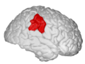右侧大脑半球：缘上回位于红色标记处