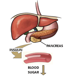English: Diagram shows insulin release from th...