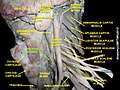 عضلات عنقية طويلة Longus colli muscle