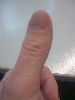 Thumb image