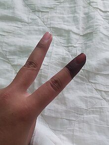 A voter's left hand index finger stained with election ink. 15th Malaysian general election. GE15 Ink.jpg