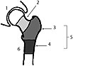 Fractuurindeling Indeling heupfracturen per anatomische regio. 1. Heupkom 2. Femurhals/Collum femoris (Intracapsulair) 3. Intertrochantair 4. Subtrochantaire fracturen 5. Extracapsulair