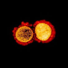 Novel Coronavirus SARS-CoV-2 (49645402917).jpg