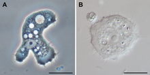 Parasite140120-fig3 Acanthamoeba keratitis.png