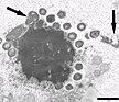 Elektronenmikroskopische Aufnahme einer Virusfabrik in einer Amöbe, die mit dem Zamilon-Virus (kleinen Partikeln) und Mont1-Virus koinfiziert ist.