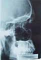 Immagine di un cranio umano ai raggi X