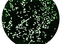 Микроскопия в темном поле выявляет бактерии Shigella dysenteriae.jpg