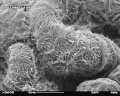 Glomerulus im REM Bildbreite ca. 22,8 µm