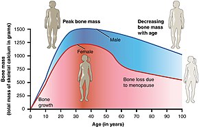 Bone density peaks at about 30 years of age. Women lose bone mass more rapidly than men. 615 Age and Bone Mass.jpg