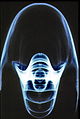 Image radiographique de nautile en agrandissement direct (foyer de 0,1 mm) : axial.