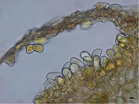 Uredinium met uredosporen van Puccinia thaliae op Canna indica