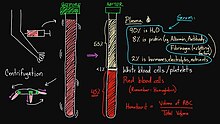 The narrator writes to an electronic blackboard during a recorded lecture. Khan Academy black board example.jpg