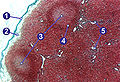 (1) ಪೊರೆಯ ಚೀಲ (capsule), (2) ಉಪ-ಪೊರೆಯಚೀಲದ ಕುಹರ (subscapular sinus), (3) ರೋಗಾಣುಗಳ ಕೇಂದ್ರಗಳು (germinal centres), (4) ದುಗ್ಧದ ಗಡ್ಡೆ (lymphoid nodule), (5?) - ಇವುಗಳನ್ನು ತೋರಿಸುತ್ತಿರುವ ದುಗ್ಧರಸ ಗ್ರಂಥಿ.