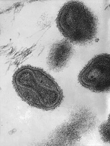 Smallpox virus virions TEM PHIL 1849.JPG