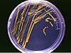 צלחת אגר עם מושבות חיידקים