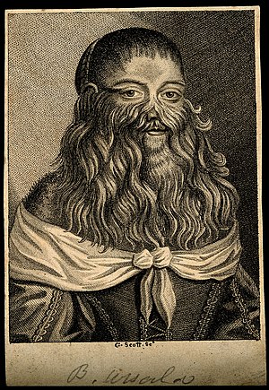 Barbara Vanbeck, a very hairy woman. Stipple engraving by G. Wellcome V0007287.jpg