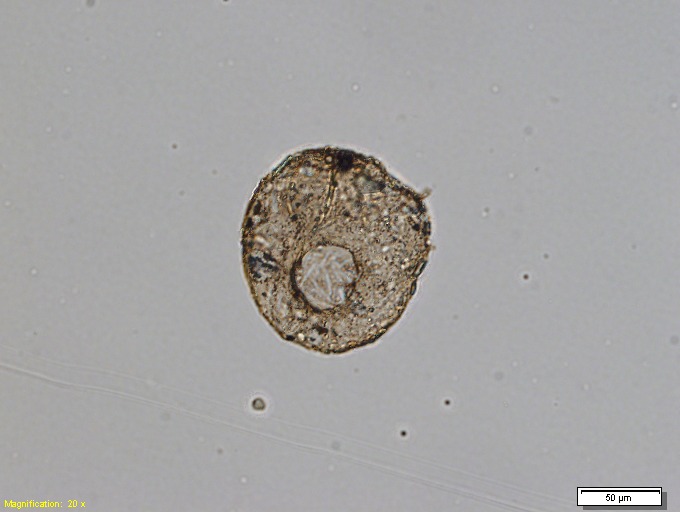 File:Collection Penard MHNG Specimen 691-1-1 Centropyxis aculeata.tif