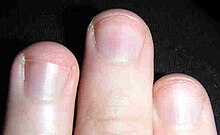 Fingernails.jpg