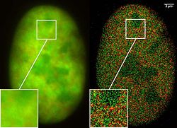 Microscopia de Super Resolução: Co-localização de microscopia (2CLM) com fusã de proeínas GFP e RFP (núcleo de uma célula de câncer ósseo) 120 000 moléculas localizadas em uma grande área (470 µm²) medido com um microcóspio Vertico-SMI/SPDMphymod