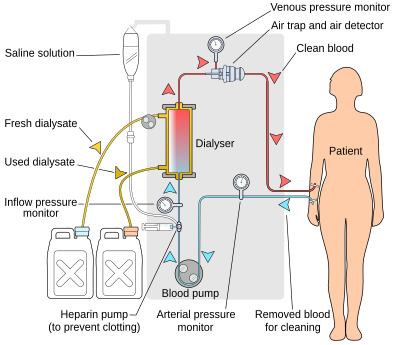 dialysis middle prince frederick md