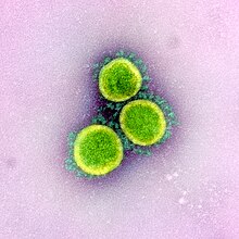 Novel Coronavirus SARS-CoV-2 (49640655213).jpg