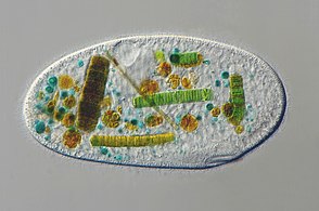 This ciliate is digesting cyanobacteria. The cytostome or mouth is at the bottom right.