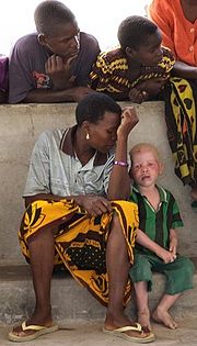A black woman and her albinistic son from Tanzania