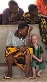 Forrest sidder en tanzanisk kvinde ved siden af sin albinodreng, hvilket illustrerer kontrasten i hudfarverne.