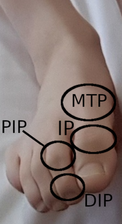 DIP, PIP, IP a MTP klouby nohy.png