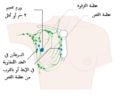 مرحلة 2A في سرطان الثدي