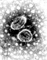 Drei Shrimp- bis Torus-förmige Viren in elektronenmikroskopischen Aufnahme (schwarz-weiß)