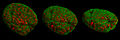 Cell nucleus in prophase from various angles