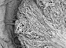 SEM image of the funicular cord on the peridiole of bird's nest fungi Funicular cord.jpg